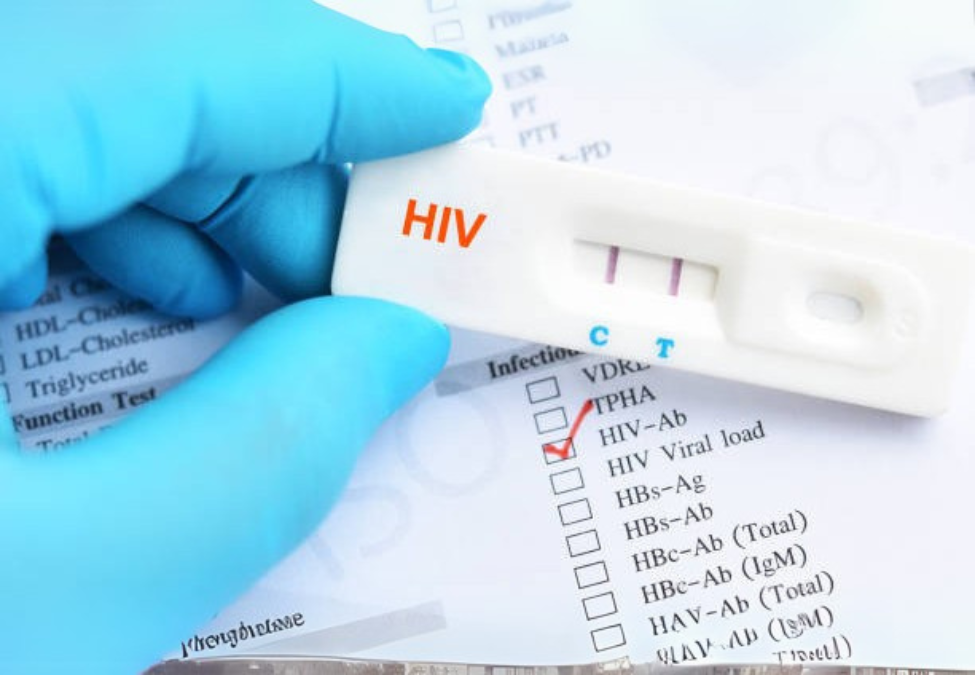 Deteksi Dini untuk Pencegahan Lebih Baik (HIV)