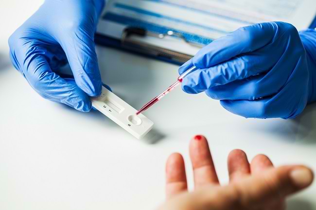 Mengenal Rapid Test: Pemeriksaan Cepat untuk Deteksi Penyakit